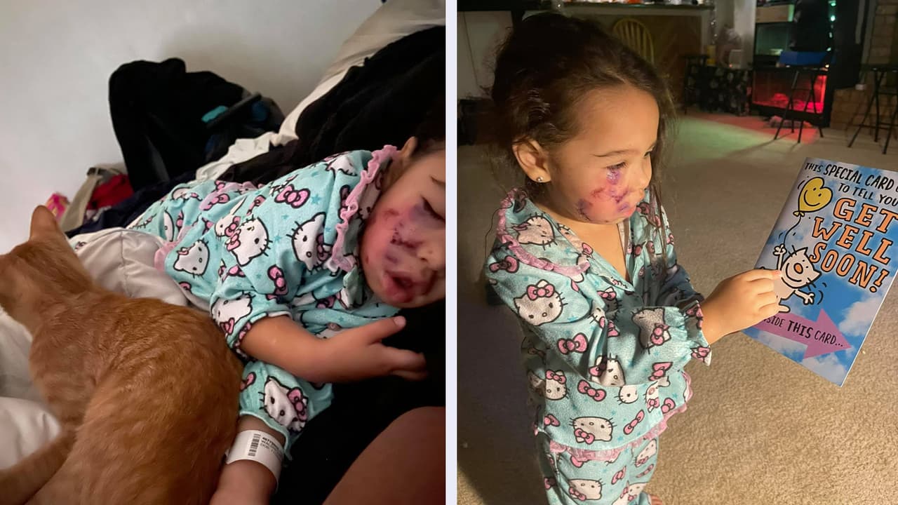 Dueña de un perro pitbull enfrenta cargos de herir a un menor tras el ataque a una niña de 3 años