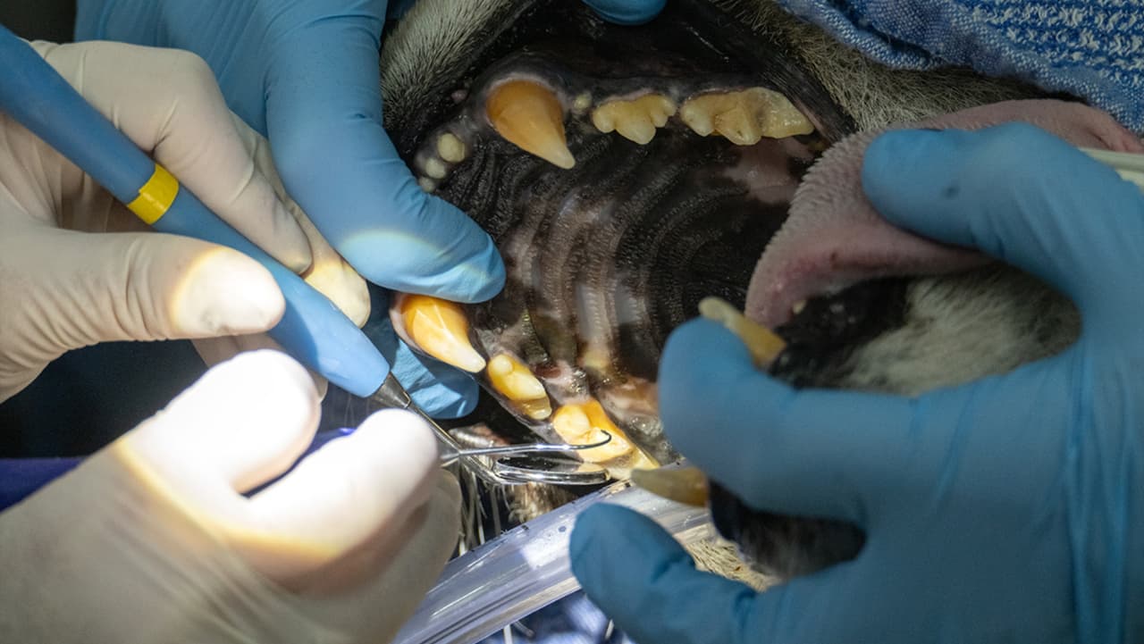 Diversas afecciones dentales, desde la enfermedad periodontal hasta dientes fracturados o quebrados, pueden provocar complicaciones médicas graves incluyendo la muerte.