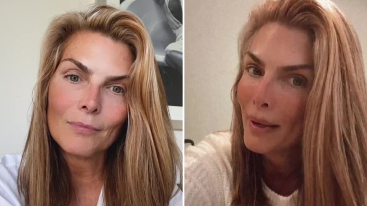 Con impactante foto, Montserrat Oliver muestra encuentro con hijo de la leona que comió parte de su dedo 