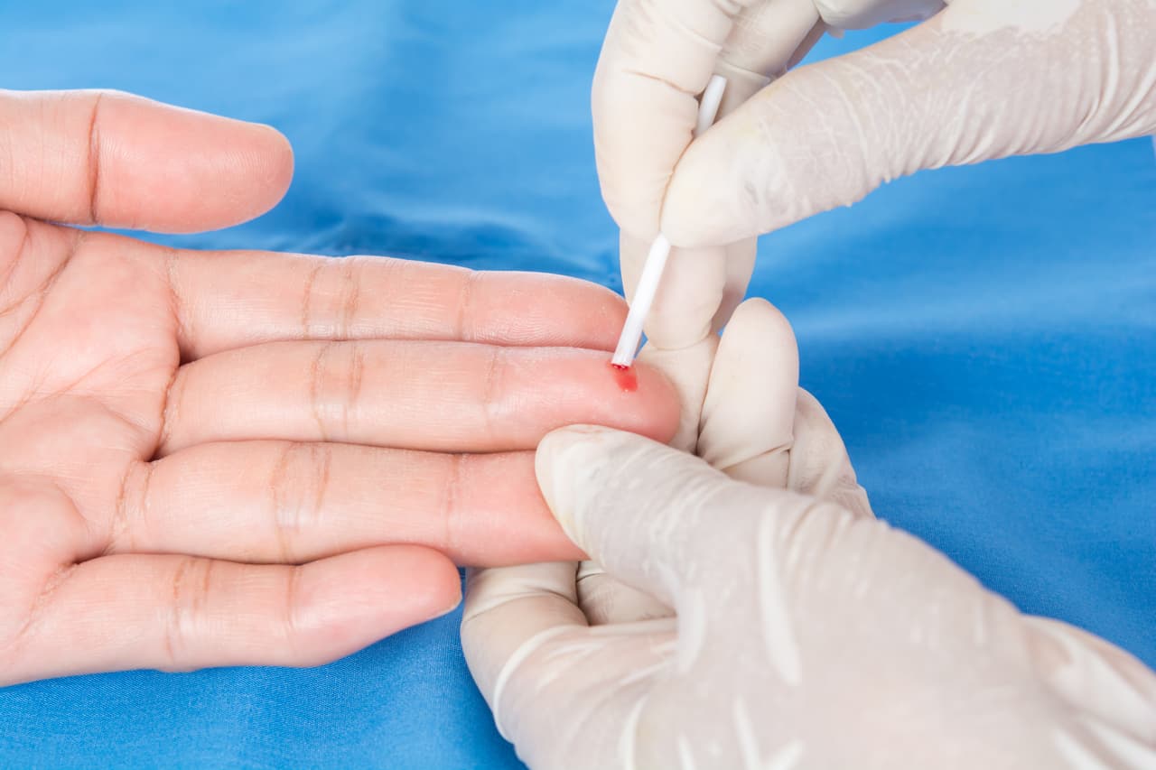 Casi la mitad de los hispanos de EEUU sufre de colesterol alto y pocos lo saben