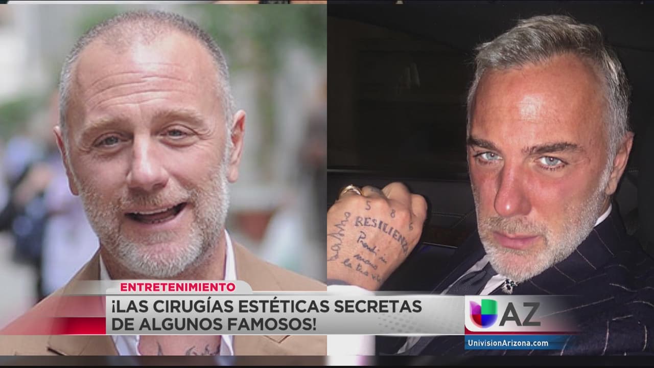 Al descubierto, las cirugías plásticas de las estrellas – Parte 2