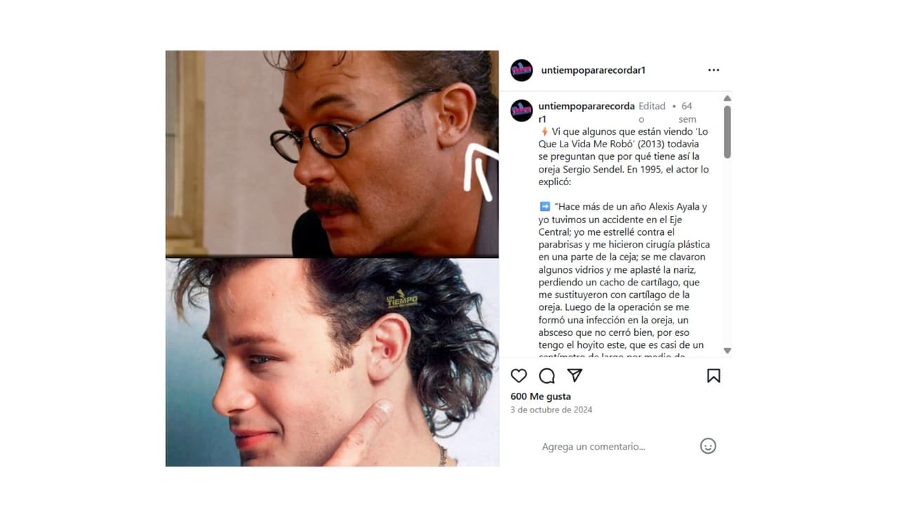 Sergio Sendel tuvo un accidente en la década de los noventa.