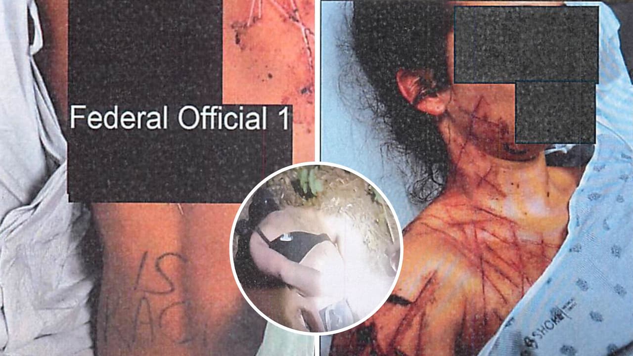 Natalie Greene, empleada de un funcionario federal, fue acusada de conspiración y declaraciones falsas tras fingir un ataque político en Nueva Jersey. La investigación del FBI reveló que pagó por escarificación corporal en Pensilvania y montó el escenario con ayuda de una cómplice. Podría enfrentar hasta 10 años de prisión.