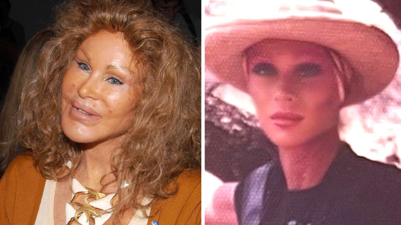 Revelan de qué murió 'Catwoman': famosa por su rostro "extremadamente alterado" por cirugías