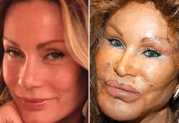 Jocelyne Wildenstein se ha sometido, desde 1975, a más de 400 operaciones.