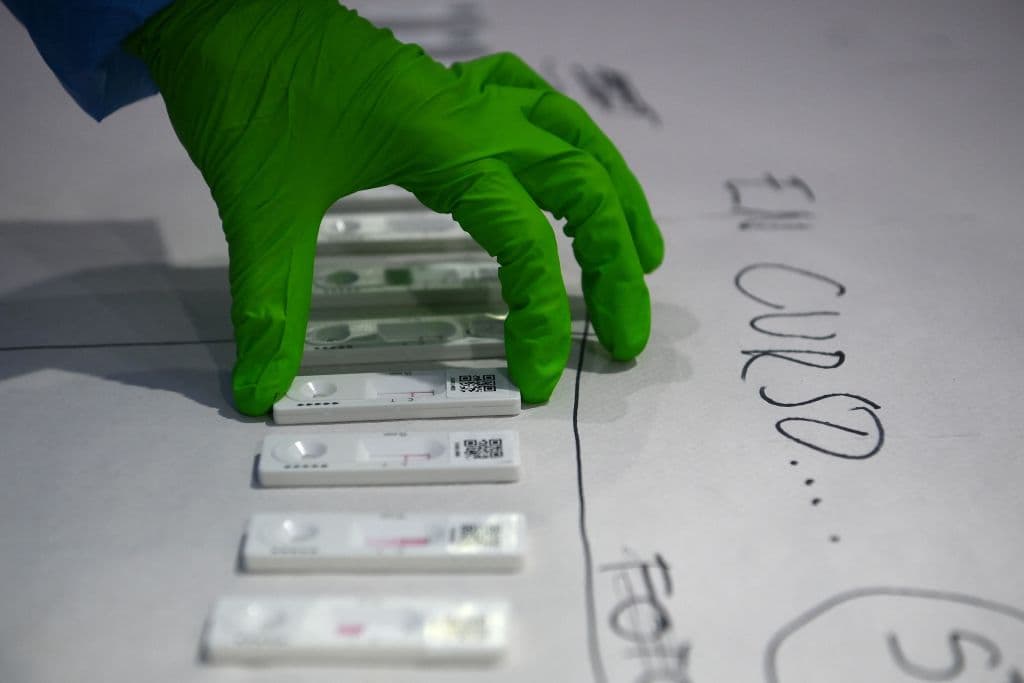 Estos son los factores más comunes que pueden producir resultados falsos en los tests de autodiagnóstico 