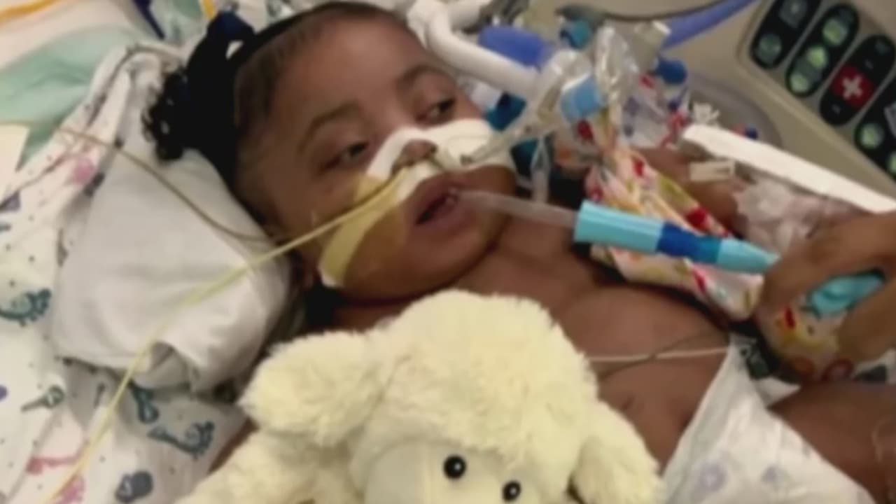 Médico de Arizona se especializa en cirugías de cráneo de bebés libre de transfusiones sanguíneas