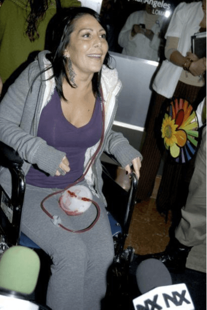 Lo que la llevó a que en el 2012 permaneciera hospitalizada por 30 días, pues se le realizaron diversas cirugías para remediar el daño.