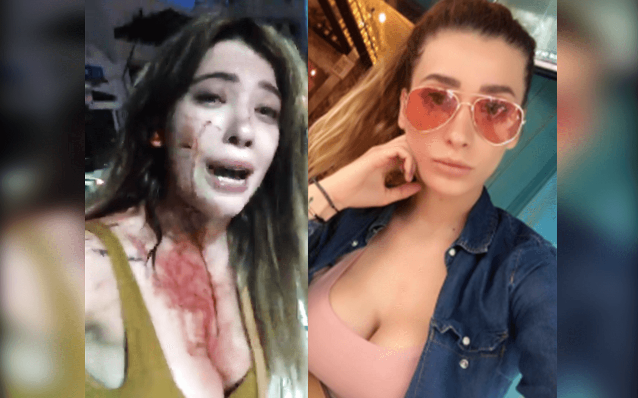 Una estrella de 'reality' denuncia que sufrió una violenta agresión en un 'strip club' en México