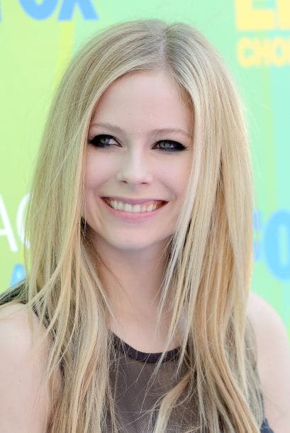 Con el paso del tiempo Avril Lavigne mejoró su sonrisa y se deshizo de los dientes de vampiro desalineados que tenía. ¡Hoy en día su sonrisa es perfecta!
