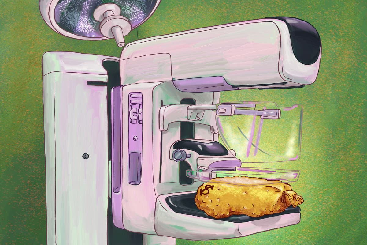 La millonaria industria detrás de las mamografías 3D. ¿Son efectivas?