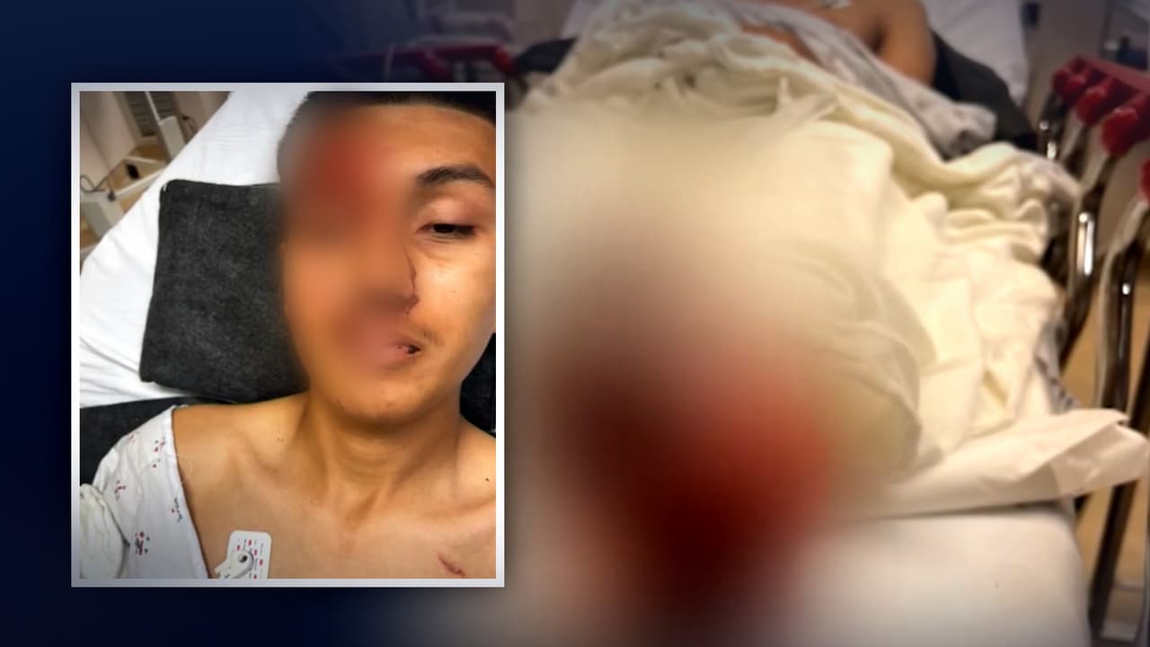 “Tiene que pagar por lo que le hizo a mi hijo": hispano atropellado a una semana de graduarse