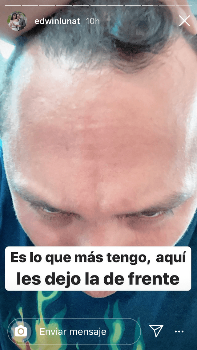 De inmediato, lo hizo a través de sus historias de Instagram con esta imagen en la que escribió "es lo que más tengo, aquí
<b> les dejo la de frente</b>". 
<br>