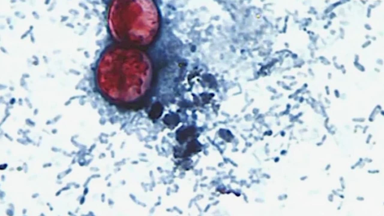 Michigan confirma las dos primeras muertes vinculadas al brote masivo de ciclosporiasis