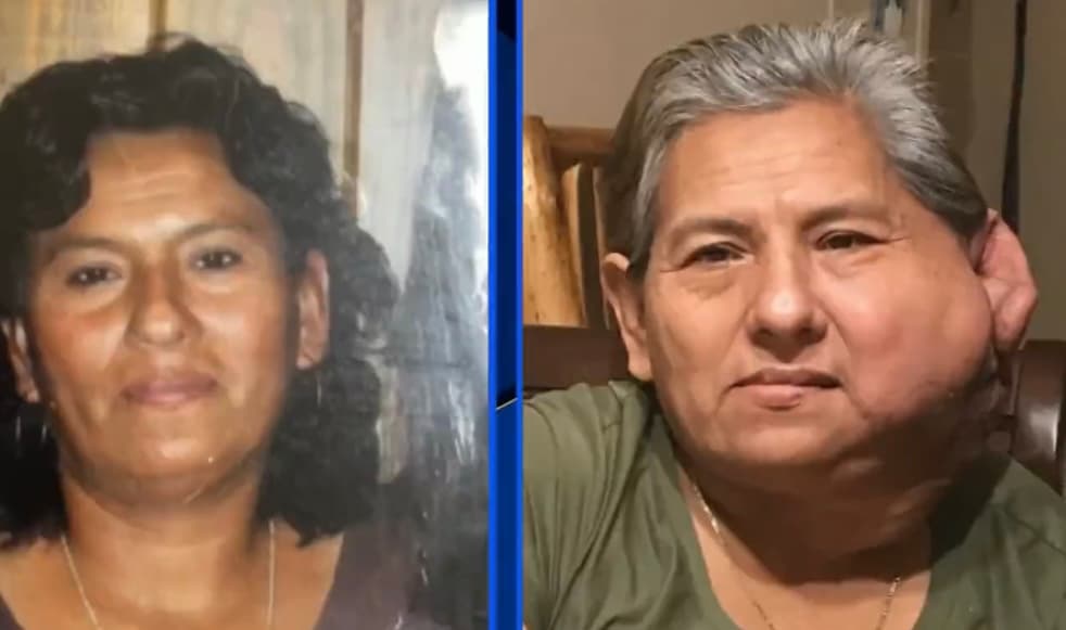 Mientras veía crecer a sus nietos, Abundio comenzó a sentir como un tumor se expandía desde su cuello hasta su oído izquierdo de una manera sobresaliente. A partir de ese momento, Abundio comenzó a transitar una pesadilla. 
<b>“He buscado ayuda en hospitales y nadie me quiere curar”</b>, dice la afligida mujer. 
<br>