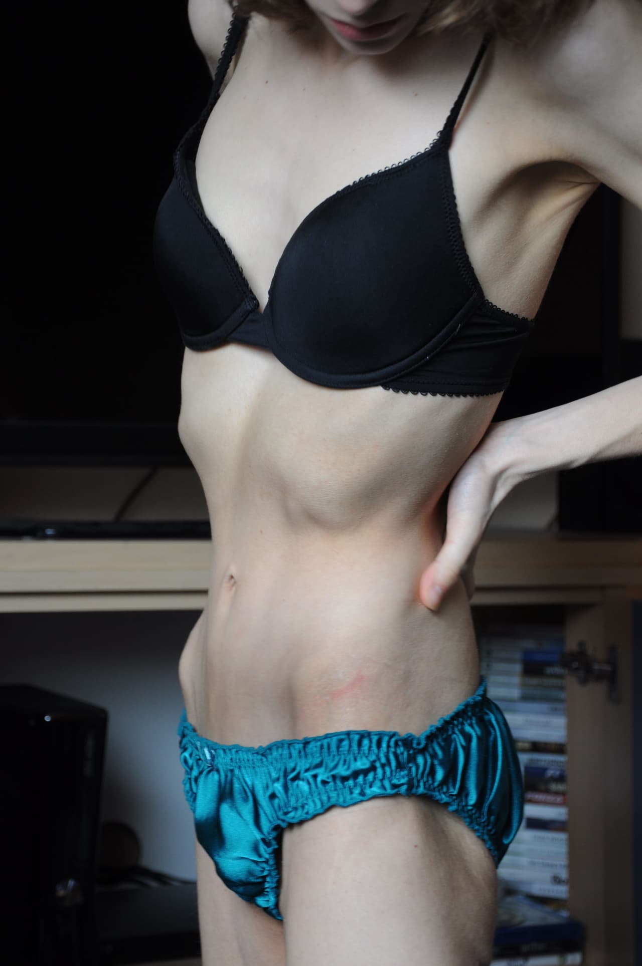 Debido a ello, empezó a saltarse comidas y dejar de comer: sólo vivía de calabaza libre de azúcar.