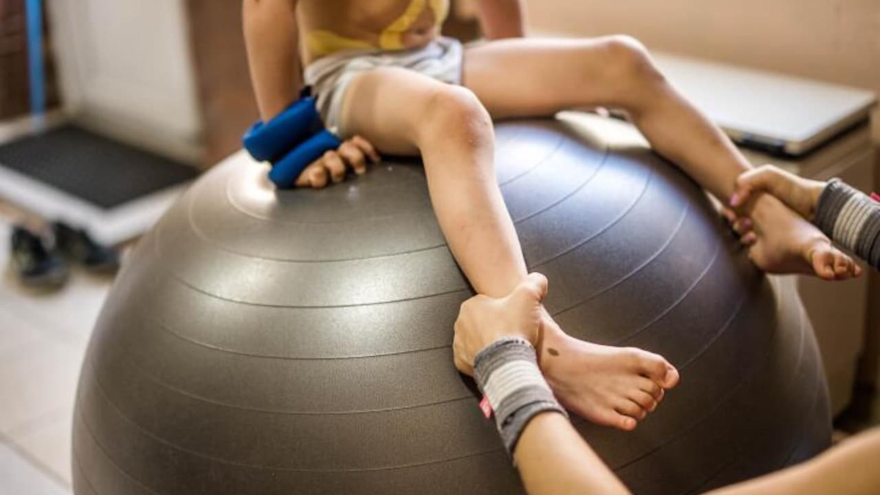 La poliomielitis o polio es una enfermedad viral que puede afectar la médula espinal causando debilidad muscular y parálisis.