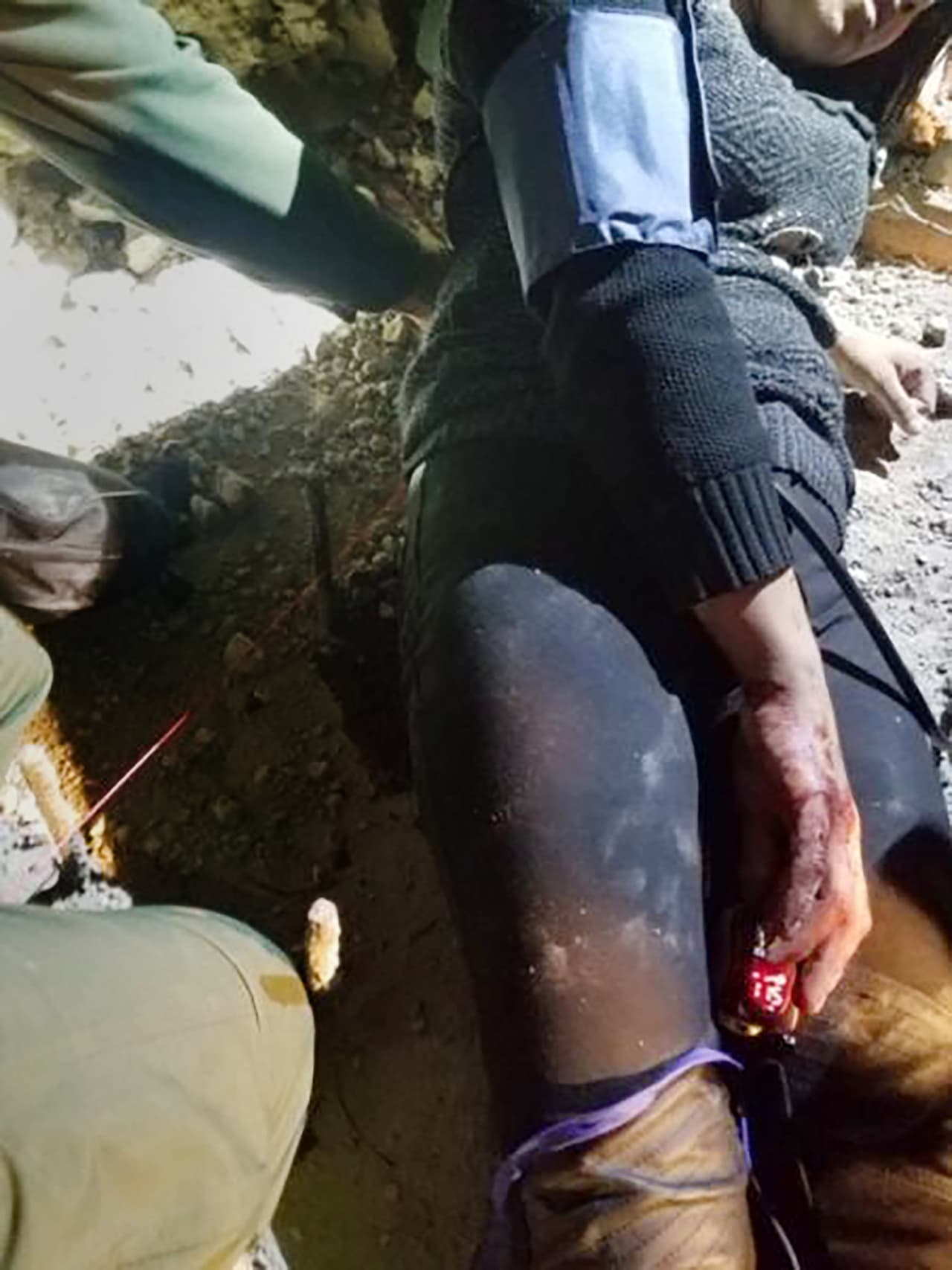 Esta mujer quedó clavada en la valla fronteriza al intentar cruzar ilegalmente a EEUU