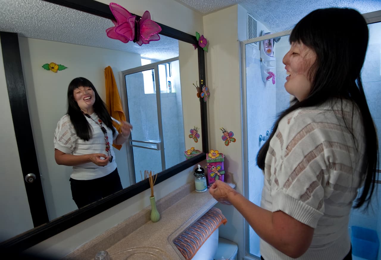 En enero del año pasado, el presidente colombiano, Juan Manuel Santos, promulgó una ley que aumenta las penas por ataques con ácido hasta 50 años. "Necesitamos ponerle freno a una tragedia que en los últimos 6 años han tenido que enfrentar 628 colombianos", dijo entonces el mandatario. En la imagen, una de las víctimas, Nubia Espitia se peina delante del espejo.