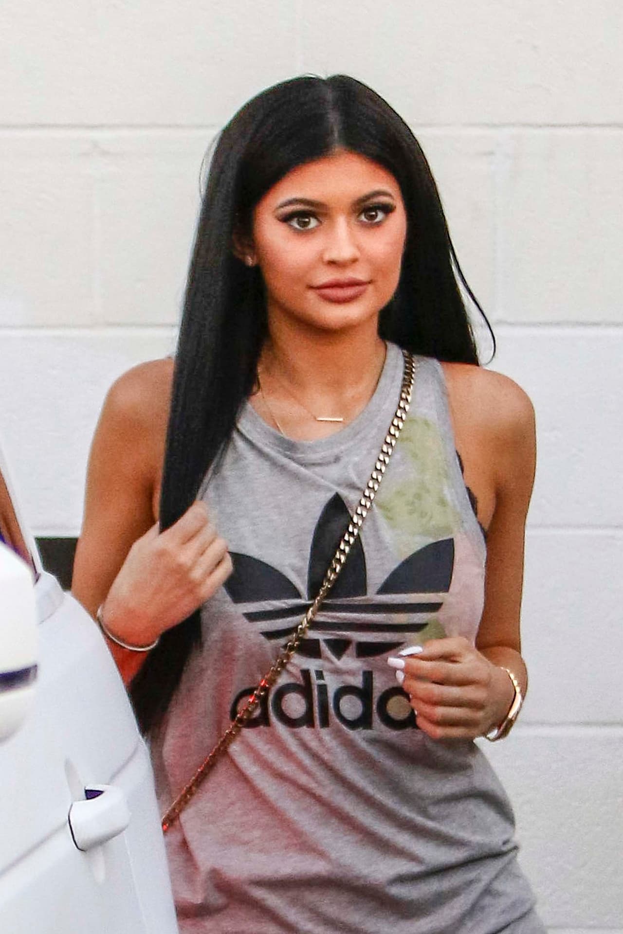 ¿Será que se hizo otros 'arreglitos'?