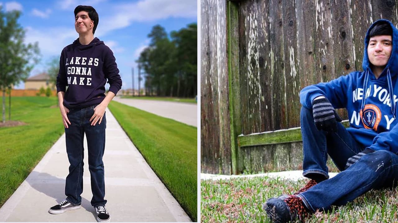 'Influencer’ hispano comparte su experiencia como inmigrante y los retos que enfrenta al padecer el síndrome de Goldenhar