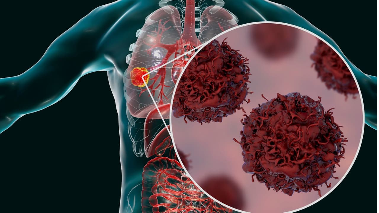 Cuida tu salud: antibióticos escasean debido a la "tormenta perfecta" de enfermedades respiratorias