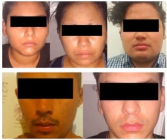 Los detenidos fueron identificados como: Yeni Vianey “N”, Mitzan Isabel “N”, Ramiro Alejandro “N”, Amín “N” y Leonel “N”.
<br>