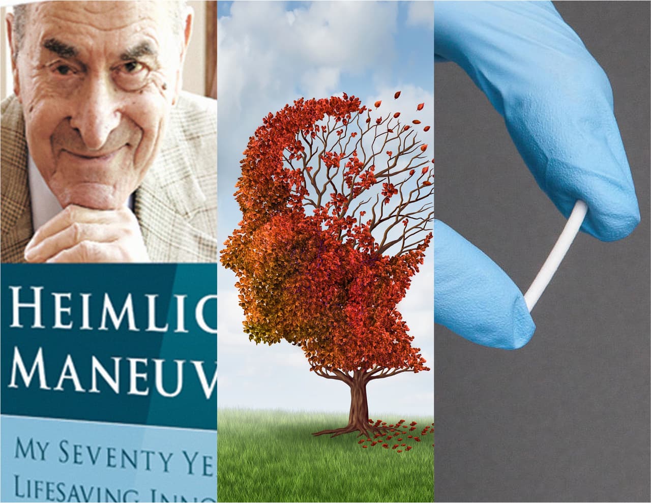 Heimlich, implantes y alzhéimer: los más recientes avances de salud