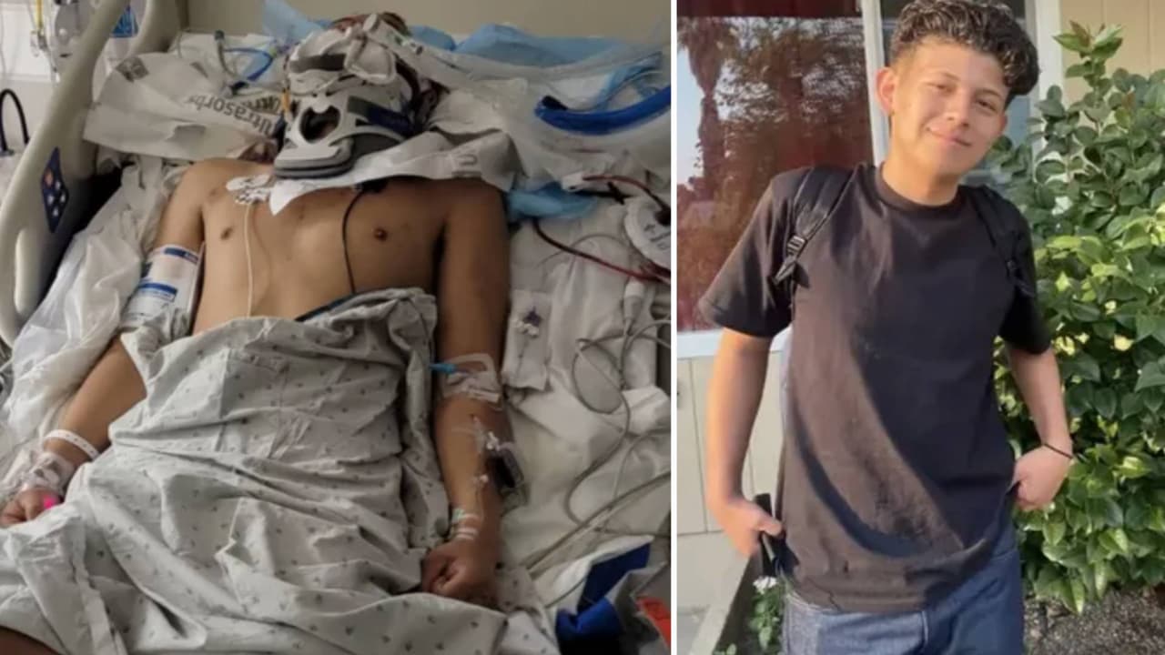 Menor hispano despierta tras 9 meses en coma después de ser empujado a una avenida en California 