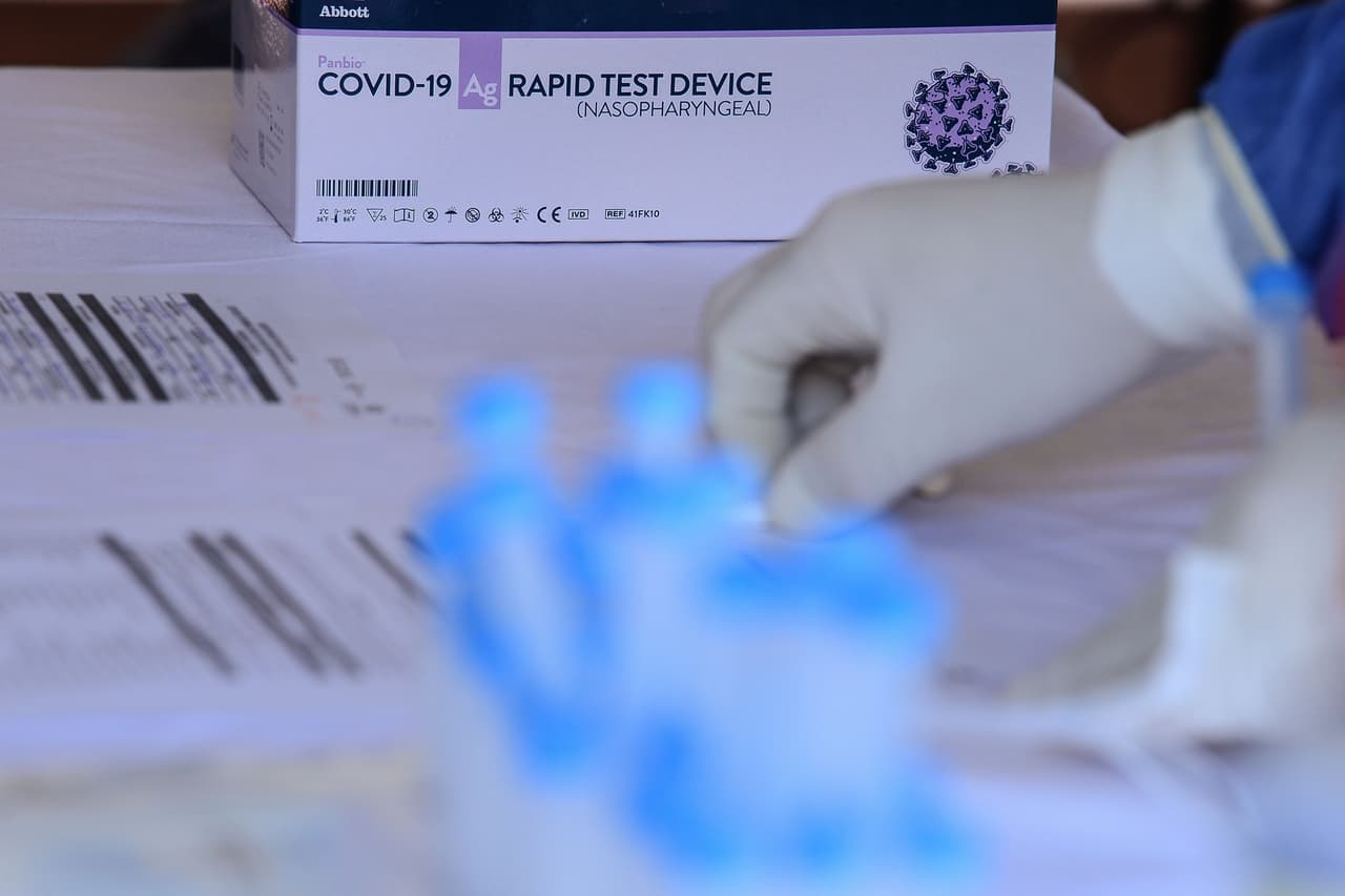 Detectan casi 100 casos de coronavirus en la Liga BBVA MX