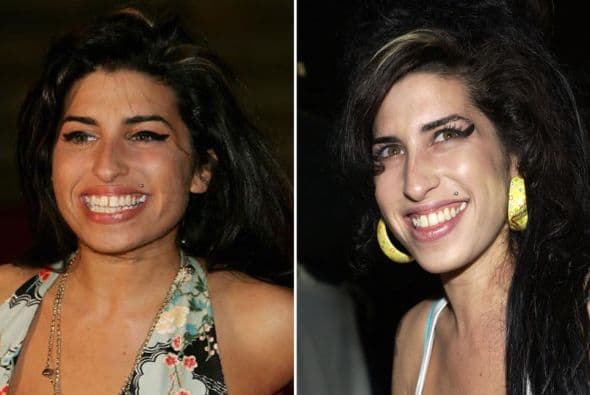 Sin embargo sí pudimos notarle algunos ligeros cambios en sus dientes de vez en cuando.