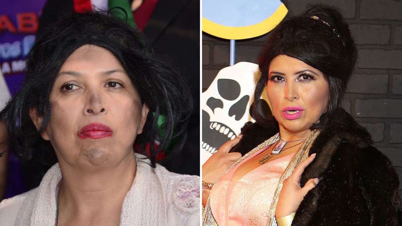 Famosa comediante padece enfermedad incurable: pensó que “era cáncer” ante fuerte tratamiento de quimio