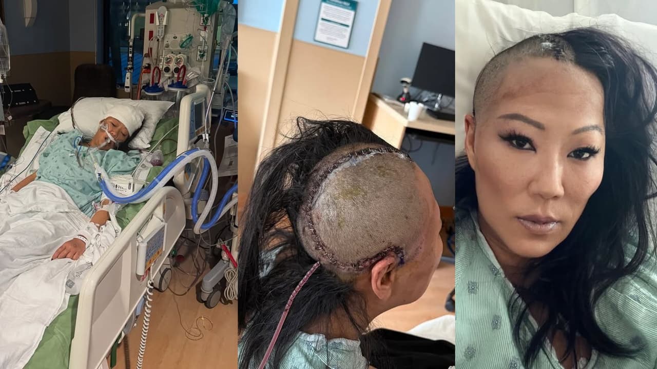 Lyn Ban fue sometida a una cirugía cerebral tras sufrir un accidente.