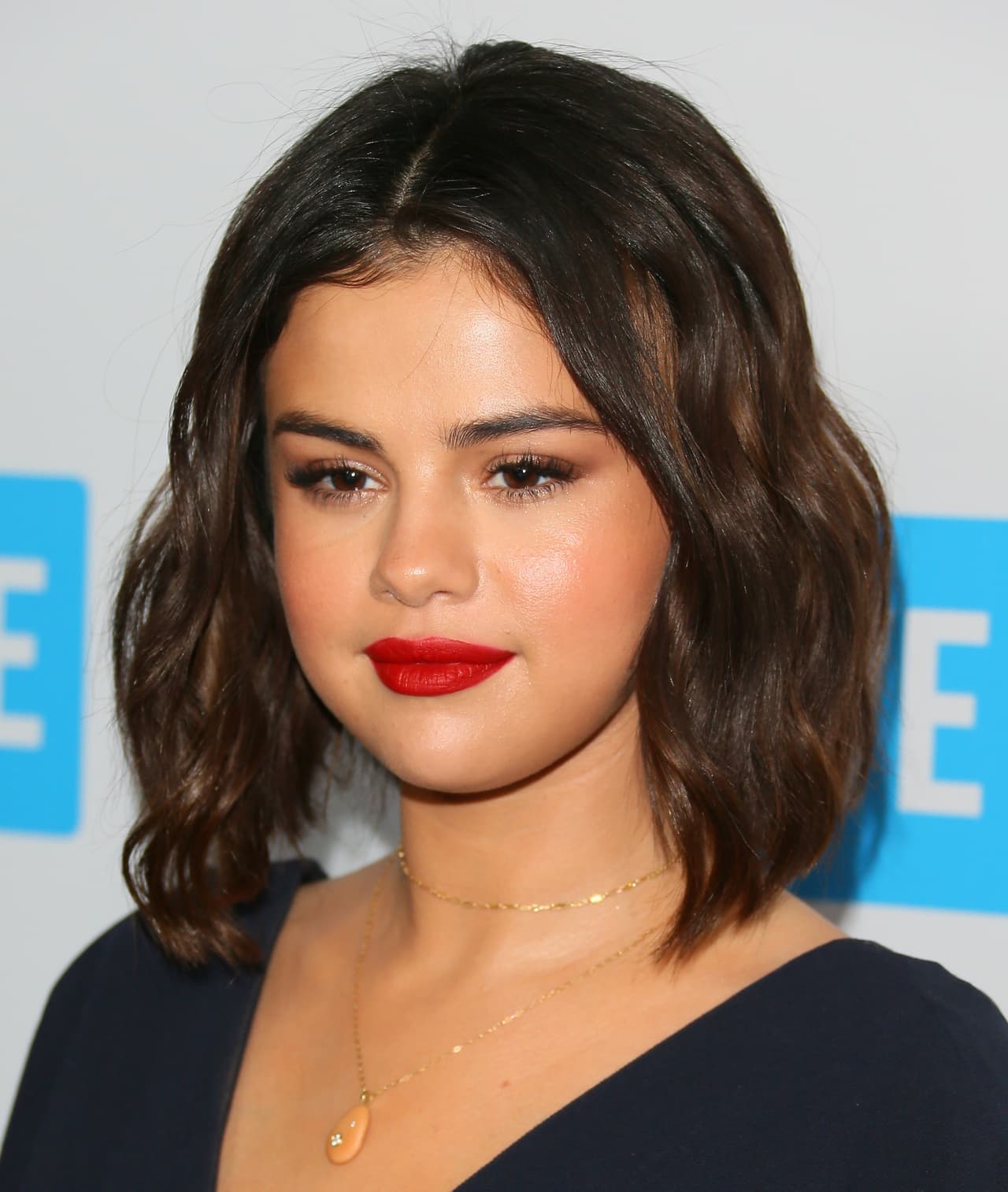 La salud de Selena se siguió mermando por esta enfermedad. En septiembre de 2017, la cantante reveló a través de sus redes sociales que había 
<a href="https://www.univision.com/entretenimiento/selena-gomez-tuvo-que-recibir-un-trasplante-de-rinon">recibido un trasplante de riñon</a> para mejorar su calidad de vida, pues los suyos estaban en condición crítica, debido a los fuertes tratamientos a los que se había sometido para tratar el lupus.