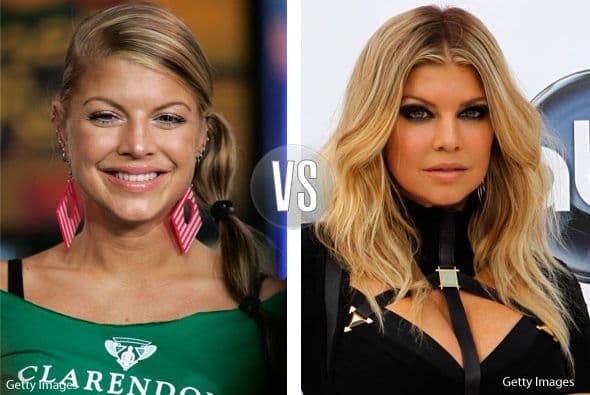 El bisturí se portó generoso con Fergie. La vocalista de los Black Eyed Peas sí que lo necesitaba.