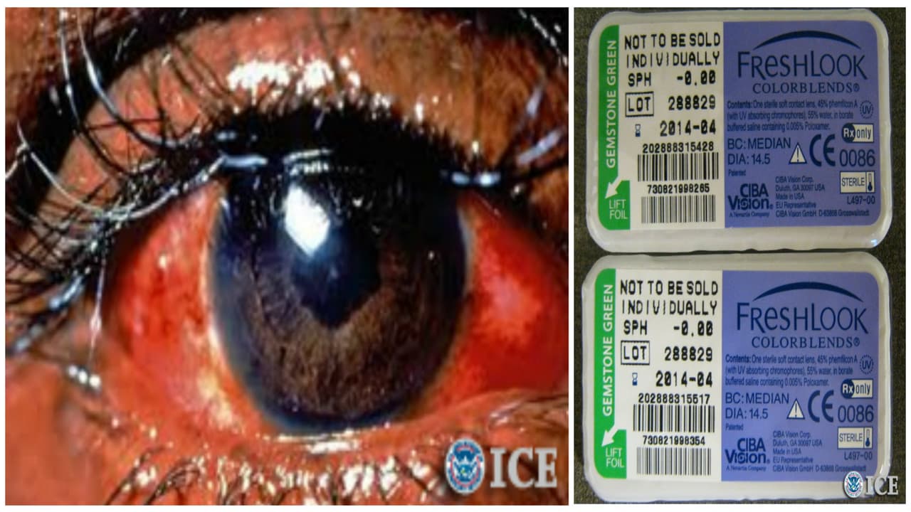 Autoridades advierten de lentes de contacto decorativos prohibidos y peligrosos