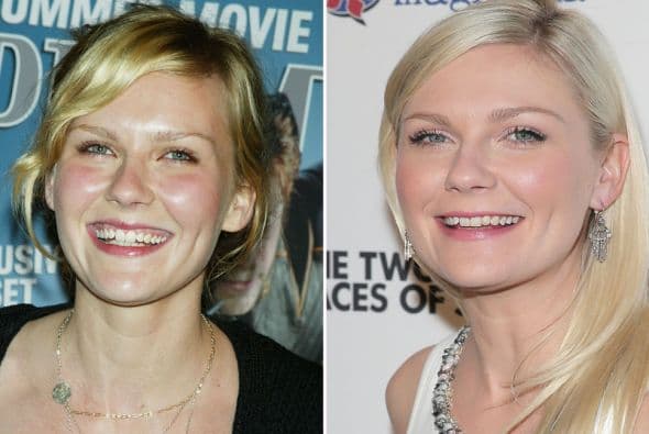 ¡Qué bueno que la sonrisa de vampirito se la desaparecieron pronto!