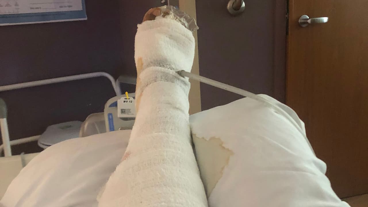 <b>La mejor forma de prevención es evitar el contacto con aguas contaminadas </b>si tienes heridas abiertas. En caso de exposición, buscar atención médica al primer signo de síntomas puede salvar vidas.