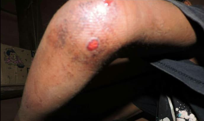 Alberto también resultó herido en el incidente.