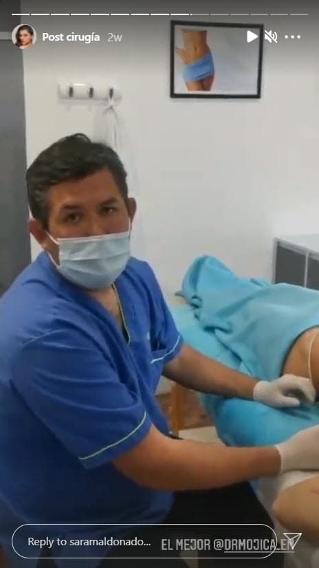 "Este tipo de cirugías estéticas se realizan a personas que quieren 
<b><a href="https://www.univision.com/famosos/sara-maldonado-encuentra-motivos-para-sonreir-dos-dias-despues-de-estallar-contra-su-expareja-fotos">moldear o mejorar su cuerpo</a></b>. Básicamente, es 
<b>quitar un poquito de grasa de ciertas zonas</b>, de ciertos cúmulos de grasa que tenía, y hacer una perfección en su cuerpo. Extrajimos la grasa que queríamos quitar", explicó.
<br>