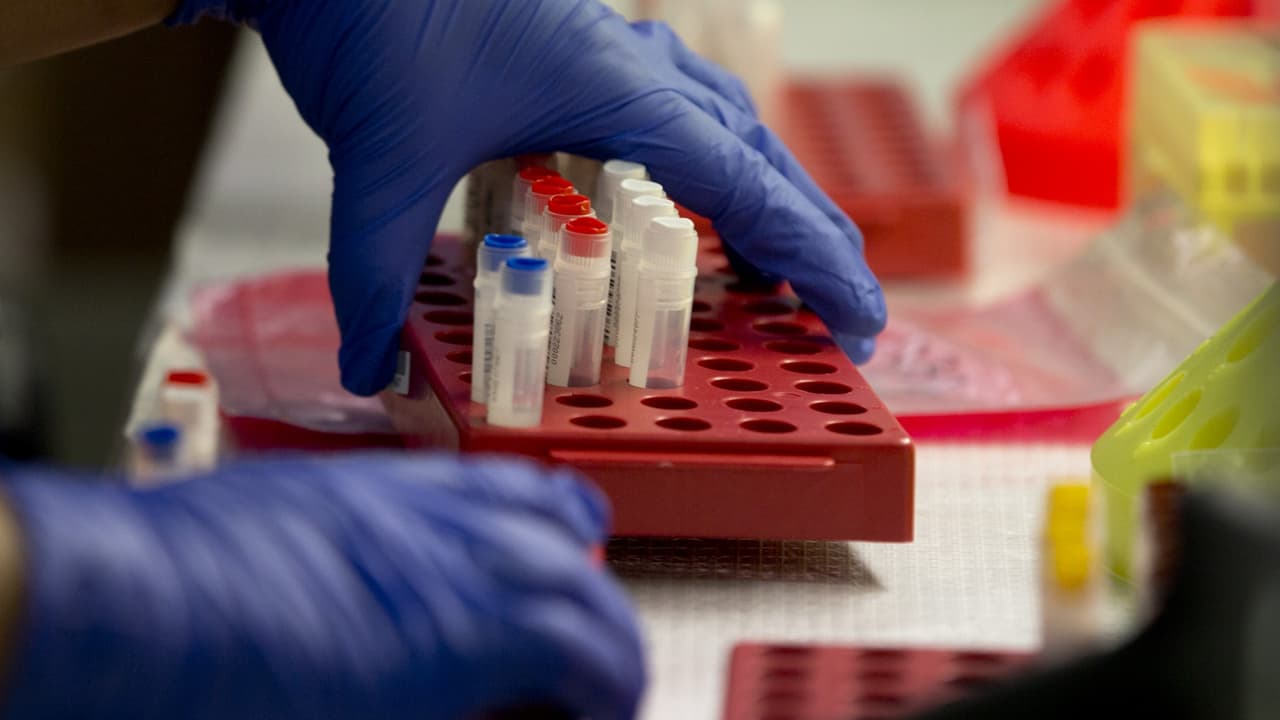 Errores sanitarios pusieron en riesgo de contagio de VIH y hepatitis a más de 3,000 pacientes en Nueva Jersey