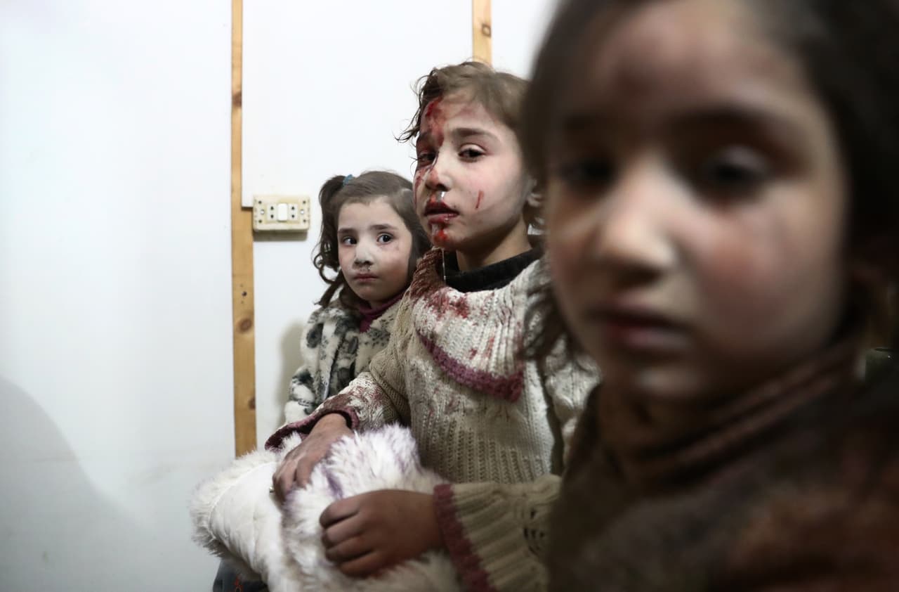 Varias niñas heridas esperan recibir tratamiento en un hospital después del ataque aéreo declarado del gobierno en la ciudad rebelde de Douma, Damasco. 25 de febrero de 2017.