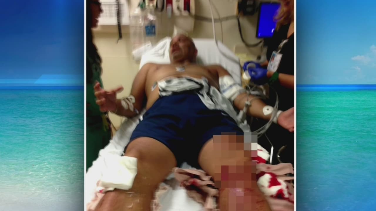 El testimonio del hispano atacado por un tiburón: "El miedo era que me arrastrara a lo profundo"