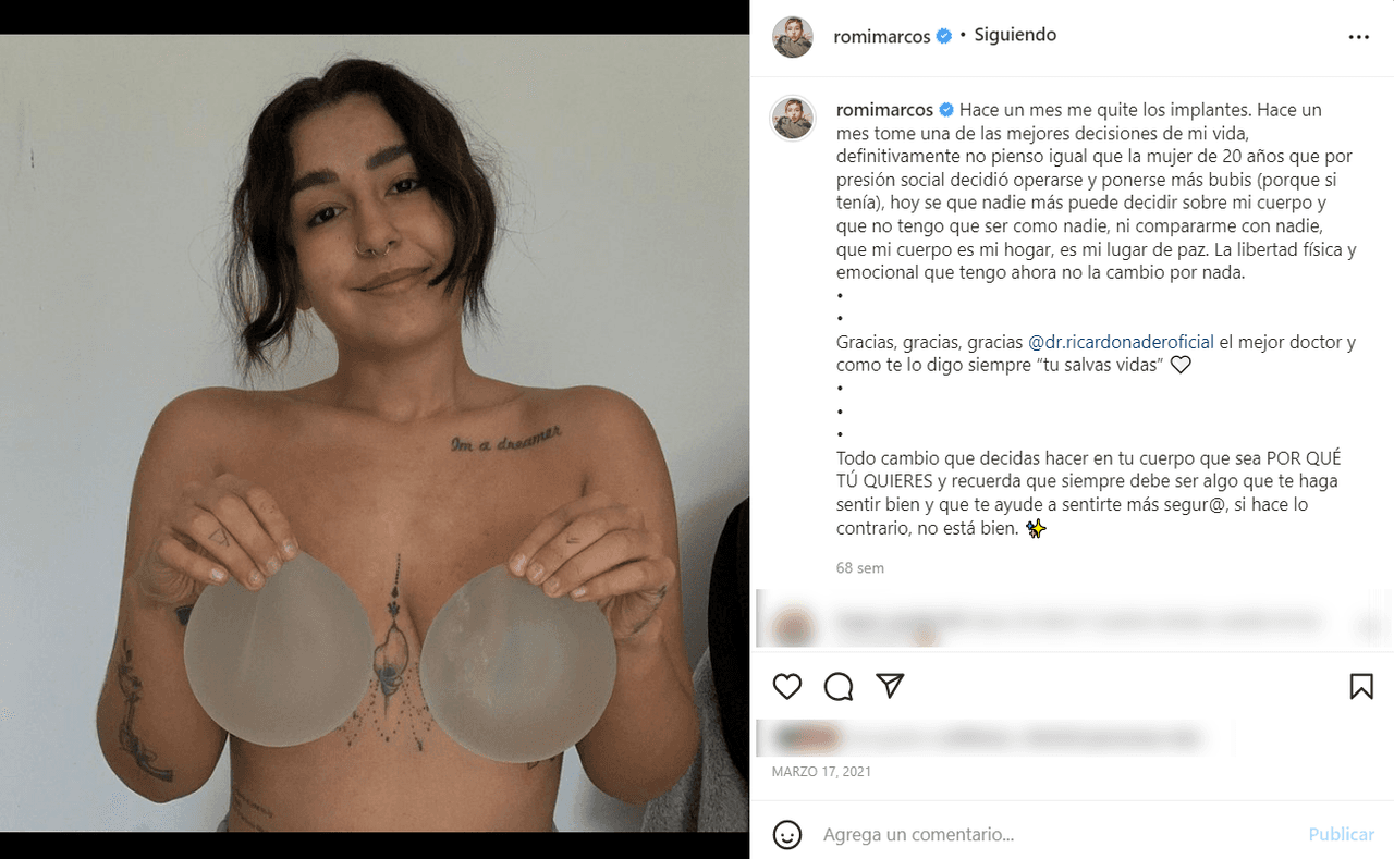 El 17 de marzo de 2021, Marcos reveló que se había 
<b>quitado los implantes de seno</b> y fue entonces cuando comenzó a compartir abiertamente su filosofía de 'body positive'.
<br>