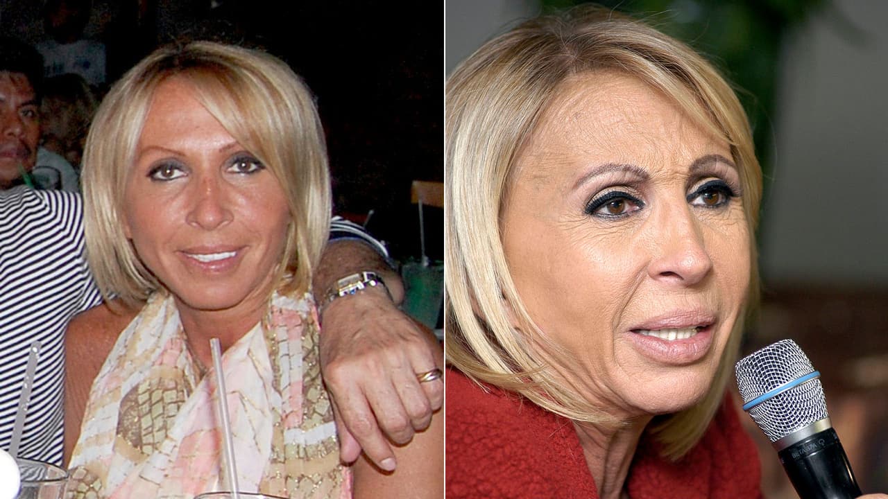 <b>Laura Bozzo</b>: la presentadora peruana se ha sometido en diferentes operaciones faciales a través de los años y también se aumentó el pecho.
<br>