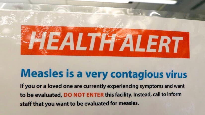 El repunte del sarampión a nivel mundial causa más de 100,000 muertos