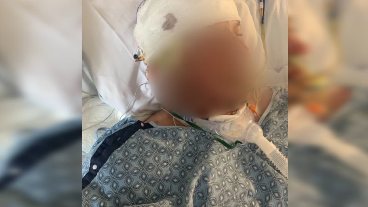 Hispano herido tras explosión en Durham pide ayuda de la comunidad