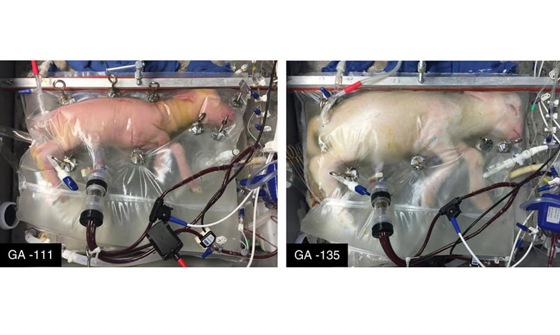 Científicos crean un vientre artificial que podría servir para bebés prematuros