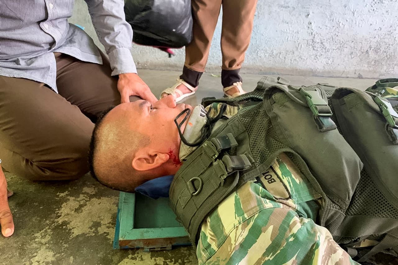 Un sargento de la milicia de la Fuerza Armada venezolana que resultó herido durante el enfrentamiento entre la Guardia Nacional Bolivariana y manifestantes en Ureña.