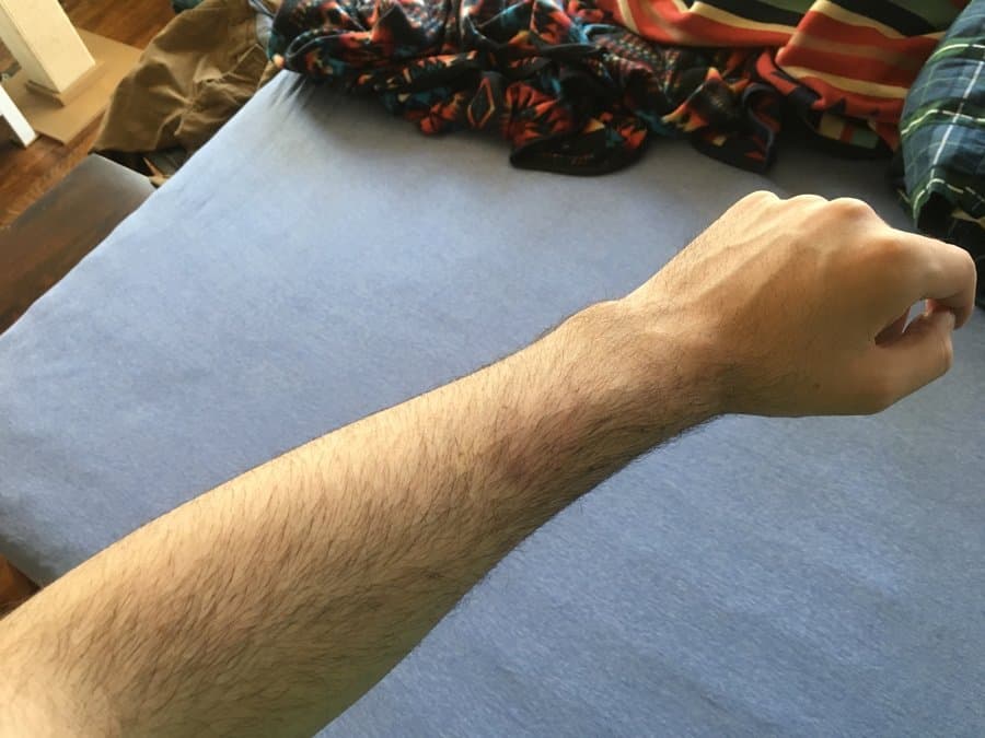 El escritor relató otro de sus sueños, en donde David lo arrastraba del brazo por un almacén abandonado. Despertó y no le dio importancia, sin embargo, descubrió un moretón en su brazo.